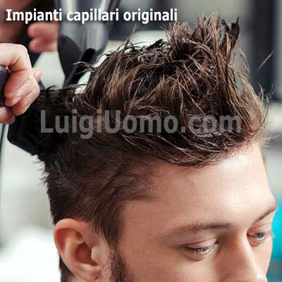 7-trapianti-trapianto-capelli-Roma-impianto-impianti-fue-capillare-per-uomo-donna-originali, 