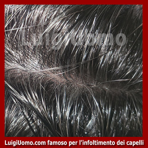 Patch-cutanea-Bassano del Grappa-3