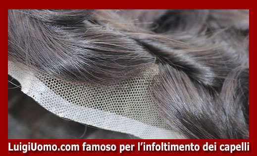 Protesi-capelli-a-Rossano-per-uomo-donna-infoltimento-capelli-impianti-capillari-patch-cutanea-membrana-capillare-