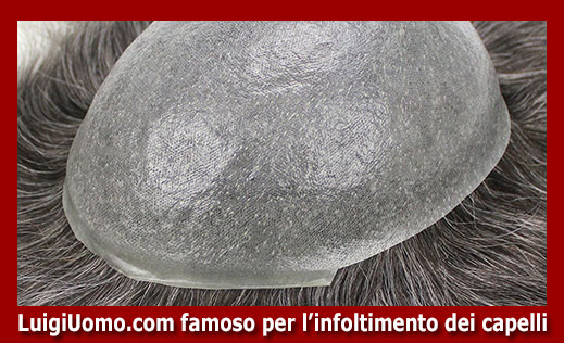 12-protesi-capelli-lace-a-Scanzano Jonico-per-uomo-donna-infoltimento-capelli-impianti-capillari-patch-cutanea-membrana-capillare-
