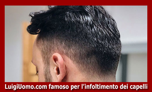 21-protesi-capelli-lace-a-Gemona del Friuli-per-uomo-donna-infoltimento-capelli-impianti-capillari-patch-cutanea-membrana-capillare-